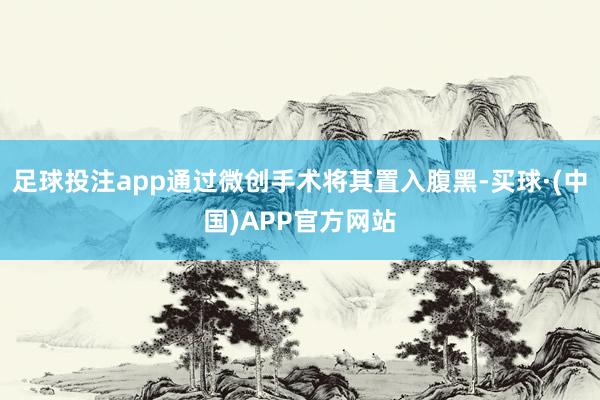 足球投注app通过微创手术将其置入腹黑-买球·(中国)APP官方网站